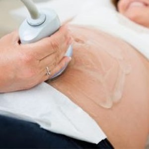 Obstetricia ginecología